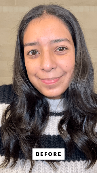 Foresto before applying the Elemis Dynamic Resurfacing Facial Pads